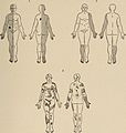 Nervous and mental diseases (1911) (14755510466).jpg
