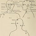 Nervous and mental diseases (1919) (14781075122).jpg