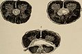 Nervous and mental diseases (1908) (14775828984).jpg