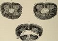 Nervous and mental diseases (1919) (14758658296).jpg