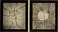 Nervous and mental diseases (1908) (14591292029).jpg