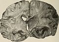 Nervous and mental diseases (1919) (14594887310).jpg
