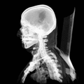 3d CT scan animation.gif