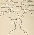 Nervous and mental diseases (1911) (14778074065).jpg