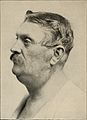 Nervous and mental diseases (1911) (14778119082).jpg