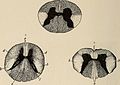 Nervous and mental diseases (1911) (14775178011).jpg