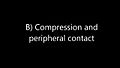 File:Nut-Cracking-Tools-Used-by-Captive-Chimpanzees-(Pan-troglodytes)-and-Their-Comparison-with-Early-pone.0166788.s003.ogv