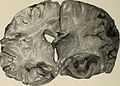 Nervous and mental diseases (1908) (14591345130).jpg
