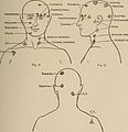 Nervous and mental diseases (1908) (14797811083).jpg