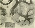 The Journal of nervous and mental disease (1874) (14764021674).jpg