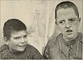 Nervous and mental diseases (1911) (14591883550).jpg