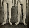 Nervous and mental diseases (1911) (14775315881).jpg