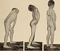 Nervous and mental diseases (1911) (14776005534).jpg
