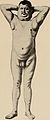 Nervous and mental diseases (1911) (14776112944).jpg